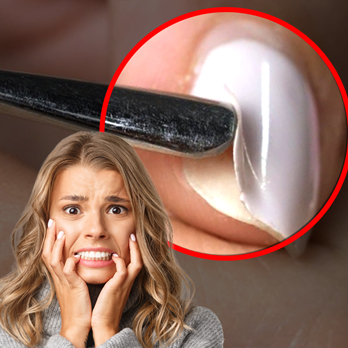 Warum platzt der Gellack ab? – 7 Fehler, die du vermeiden solltest